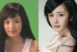 明星爆料整容视频大全最新,明星整容真相大曝光，视频大全揭秘美丽背后的秘密